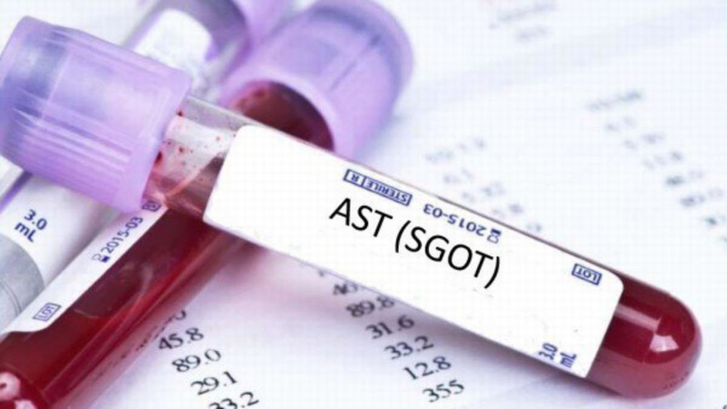 Xét nghiệm SGOT/AST là gì? Tìm hiểu vai trò và ý nghĩa trong chẩn đoán