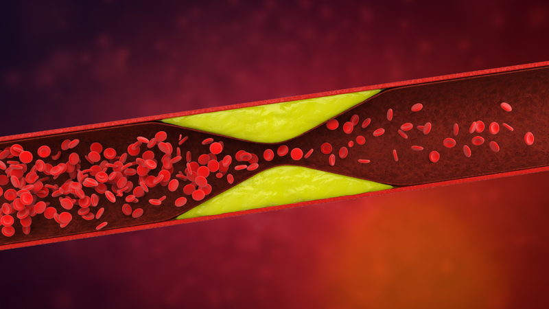 Cholesterol có phải là mỡ máu không? Sự khác nhau của cholesterol và mỡ máu 