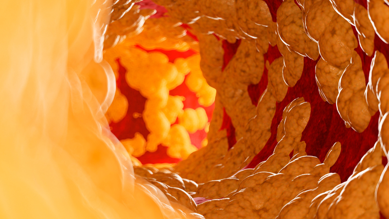 Cholesterol có phải là mỡ máu không? Sự khác nhau của cholesterol và mỡ máu 2