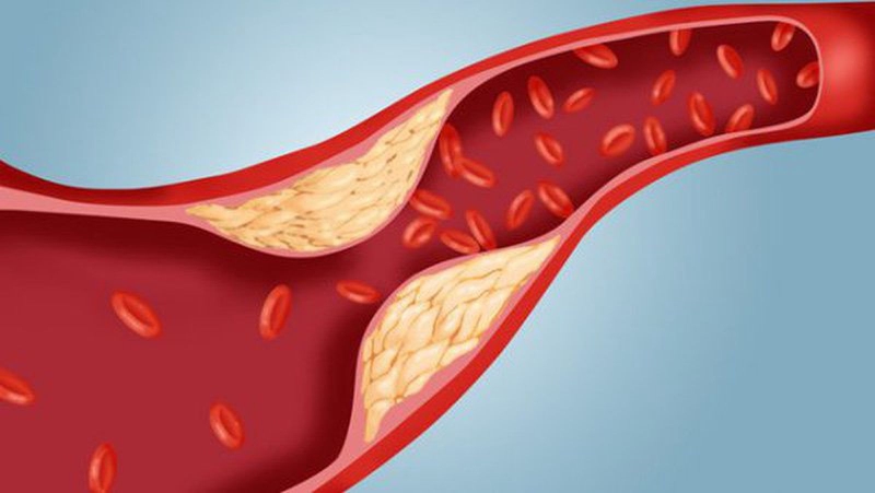 Cholesterol là gì? Kiểm soát cholesterol trong máu thế nào? 2