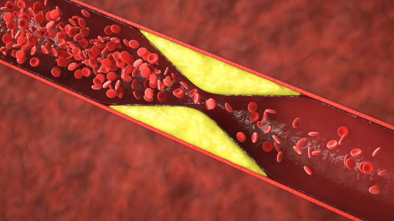 Cholesterol trong máu là gì? Cách giảm cholesterol trong máu 4