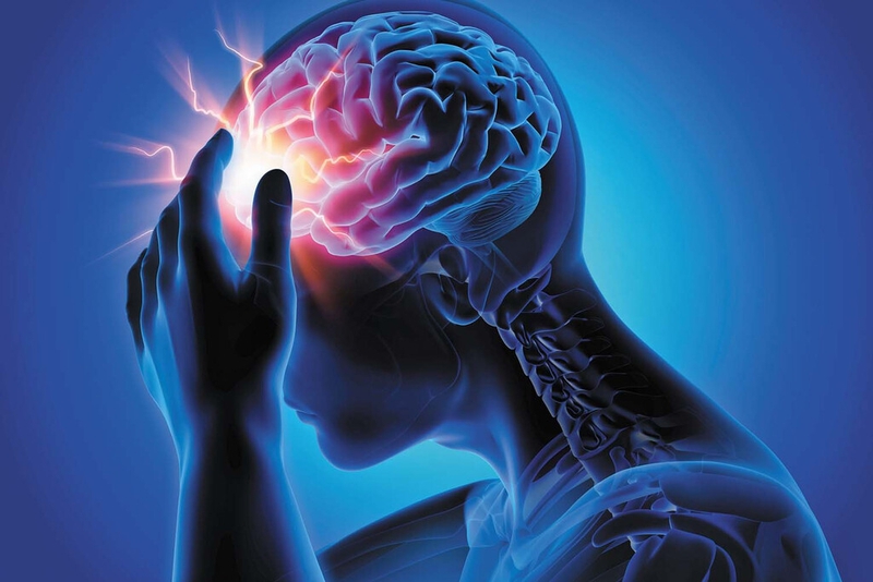 Chụp MRI mạch máu não là gì? Những trường hợp nào chống chỉ định chụp MRI mạch máu não? 3