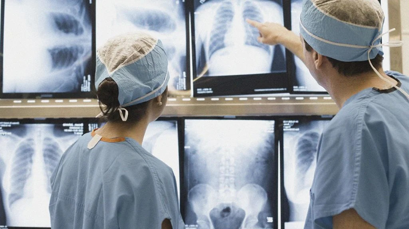 Chụp X quang phổi có vết mờ cảnh báo bệnh gì 3