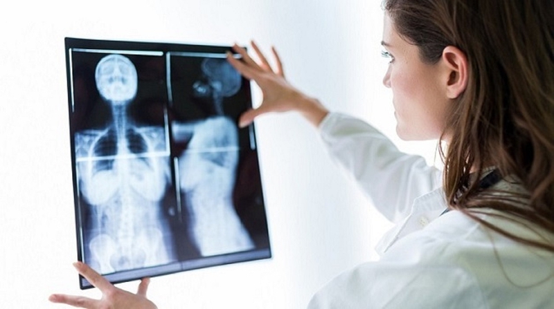 Chụp X quang tắc ruột là phương pháp gì?