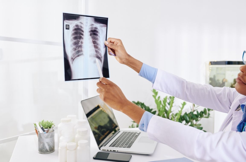 Tìm hiểu chi tiết về kỹ thuật chụp X quang tim phổi 2