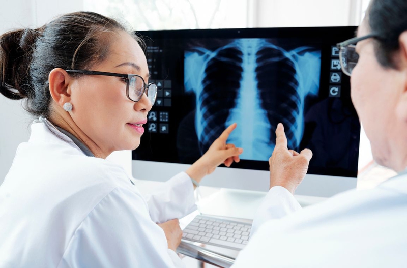 Tìm hiểu chi tiết về kỹ thuật chụp X quang tim phổi 3