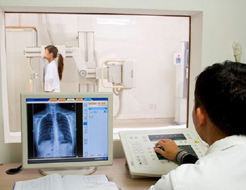 Chụp X-quang thực quản –  Bạn cần biết những gì?