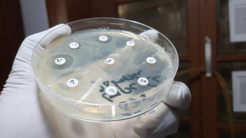 Clo test: Phương pháp chẩn đoán nhiễm vi khuẩn HP 6