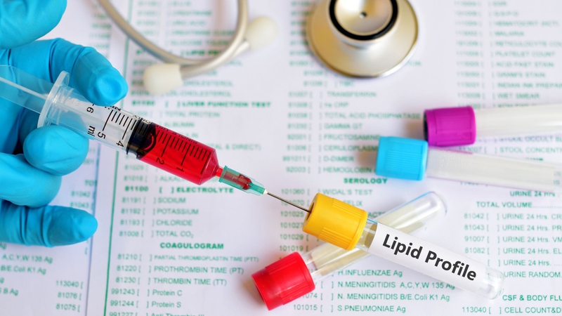 Cơ chế rối loạn lipid máu trong đái tháo đường​ và những điều cần biết 3