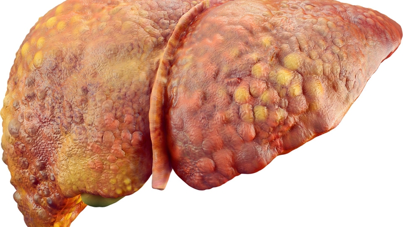 Cơ chế rối loạn lipid máu trong đái tháo đường​ và những điều cần biết 4