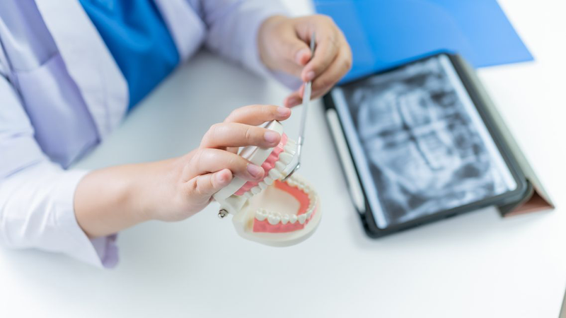 Có nên bọc răng sứ không​? Ưu và nhược điểm bạn cần biết 3