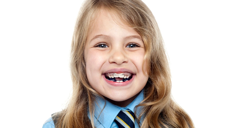 Có nên niềng răng cho trẻ 9 tuổi? Độ tuổi nào phù hợp niềng răng 1