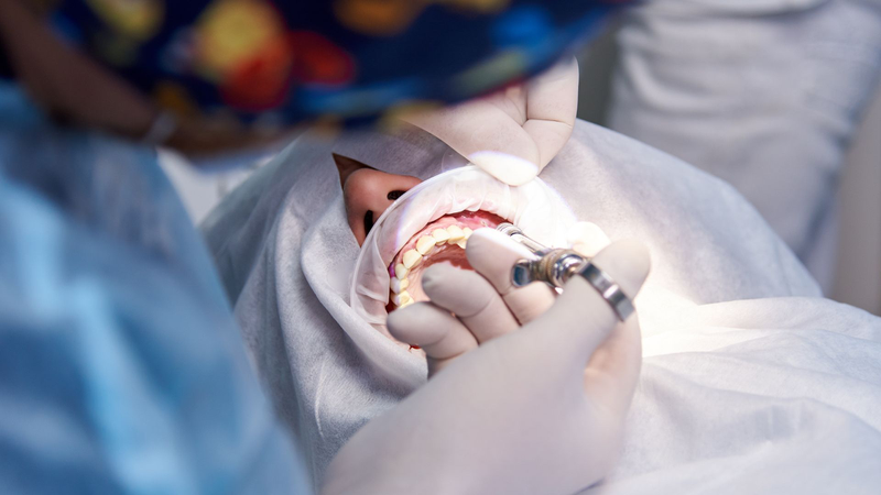Có nên uống thuốc cầm máu sau khi nhổ răng? Những lưu ý quan trọng khi nhổ răng bạn cần biết 6