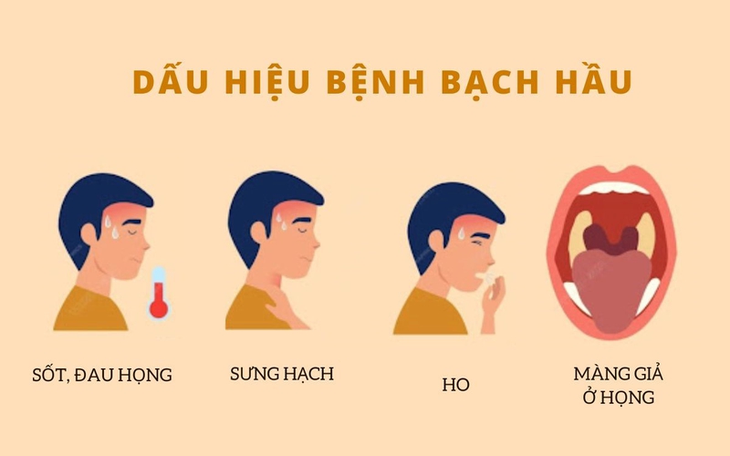 Có phải tiêm nhắc lại bạch hầu không? Thời gian nhắc lại là khi nào? 1