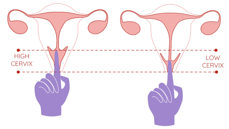 Cổ tử cung cao là gì? Nguyên nhân nào gây cổ tử cung cao? 2