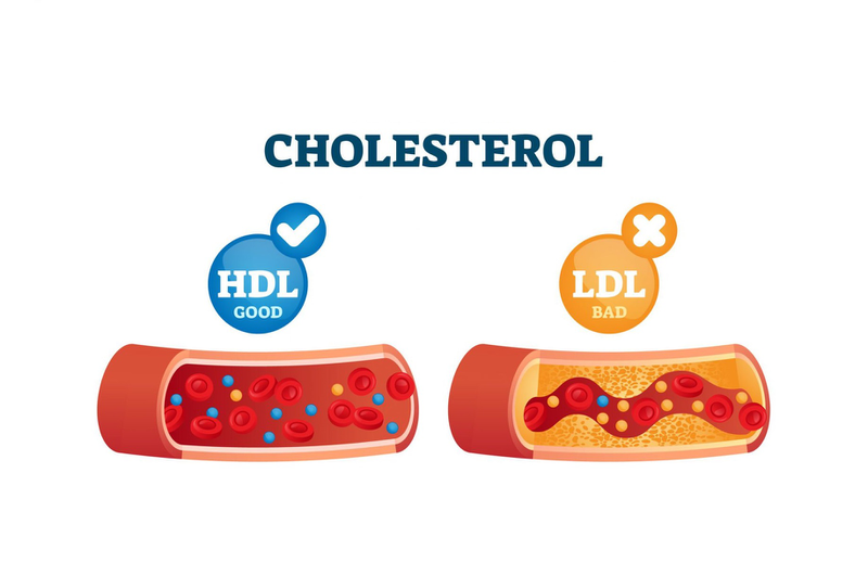 Tìm hiểu chi tiết về công thức tính LDL Cholesterol phổ biến 2