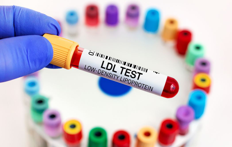 Tìm hiểu chi tiết về công thức tính LDL Cholesterol phổ biến 4