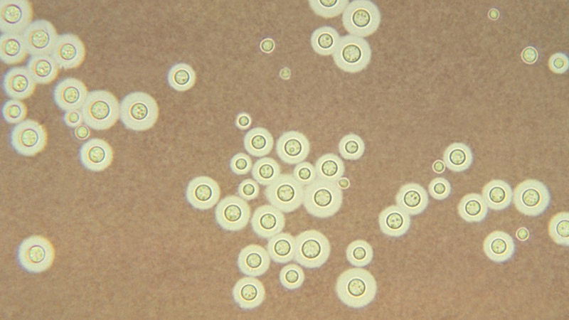 Cryptococcus neoformans là gì? 3 bệnh lý thường gặp và cách phòng ngừa 1