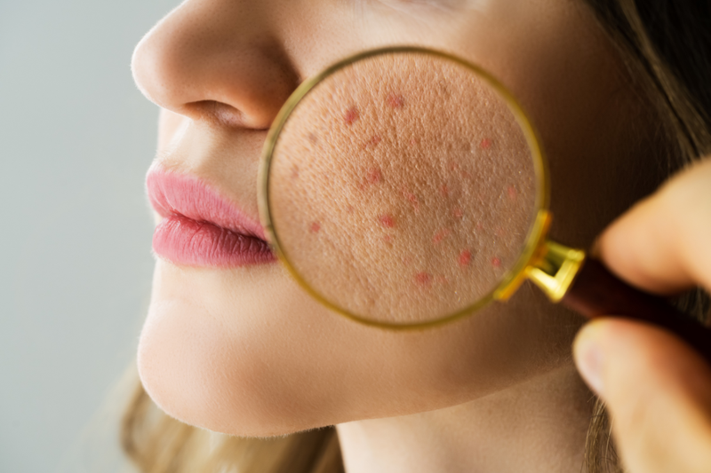 Da dầu cần bổ sung vitamin gì? Gợi ý một số dưỡng chất dành cho da 1
