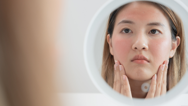 Da mặt khô: Nguyên nhân và cách khắc phục hiệu quả ngay tại nhà 6