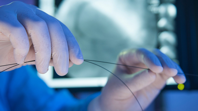 Đặt stent tim là gì? Những điều cần biết về quy trình đặt stent tim 4