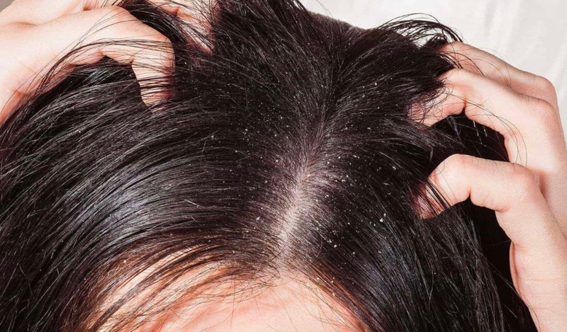 Dầu dừa có tác dụng gì cho tóc? Công thức chăm sóc tóc 1