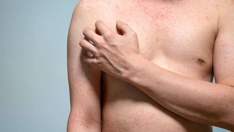 Tìm hiểu chi tiết dấu hiệu HIV từng giai đoạn 2