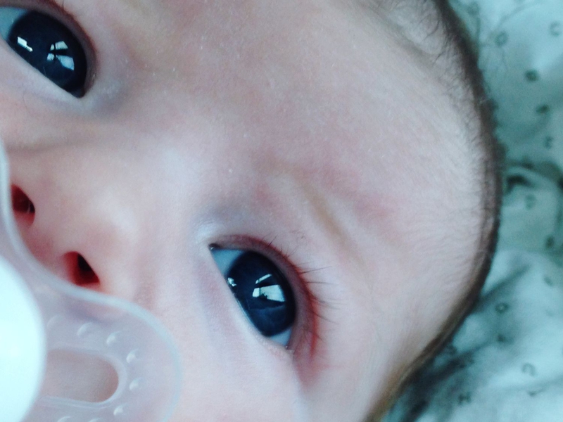 Dấu hiệu mắt trẻ sơ sinh không bình thường biểu hiện như thế nào?1