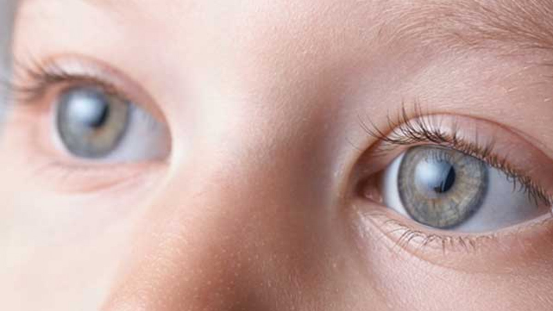 Dấu hiệu mắt trẻ sơ sinh không bình thường biểu hiện như thế nào?4