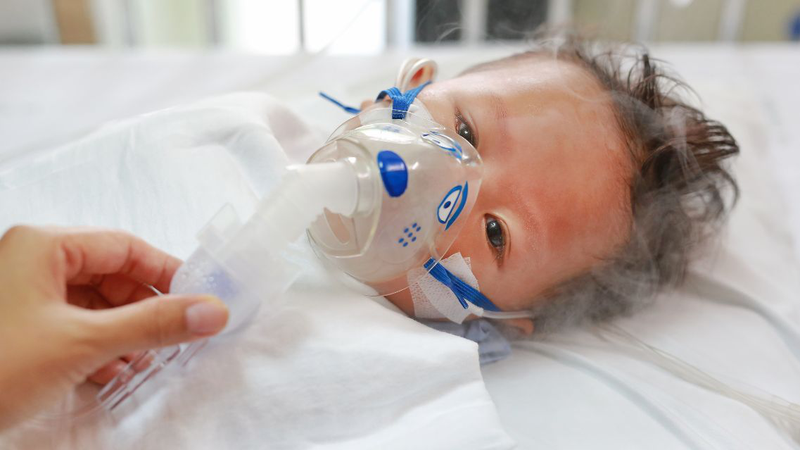 5 dấu hiệu nhiễm virus RSV ở trẻ sơ sinh cha mẹ nên cảnh giác 3