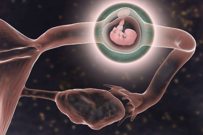 Dấu hiệu thai ngoài tử cung tự tiêu và những điều bạn cần biết 2