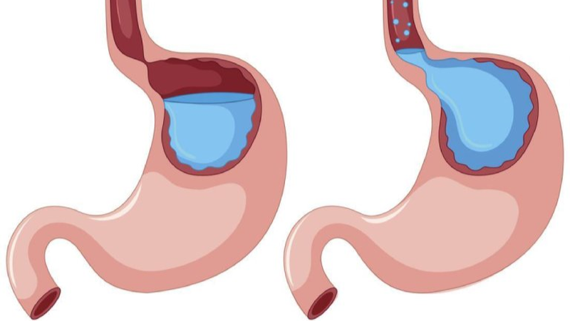 Đau rát vòm họng trên: Nguyên nhân, triệu chứng, cách điều trị 1