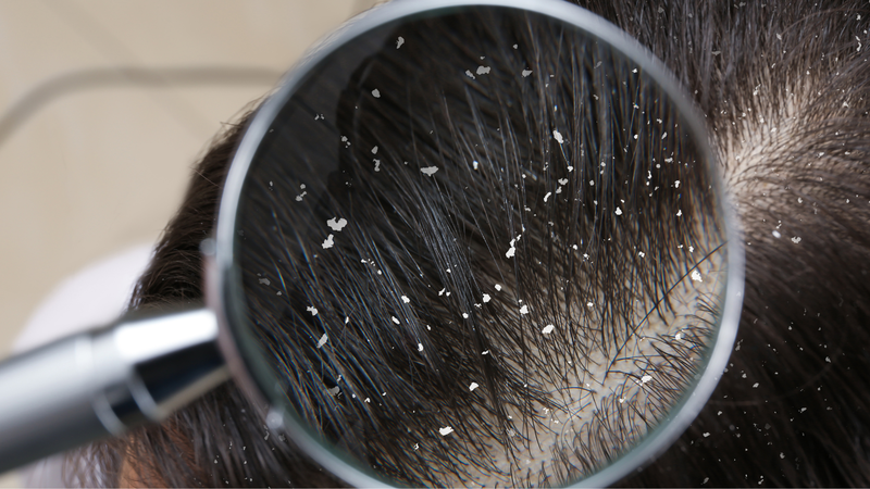 Detox da đầu là gì và mang lại những lợi ích gì? 2