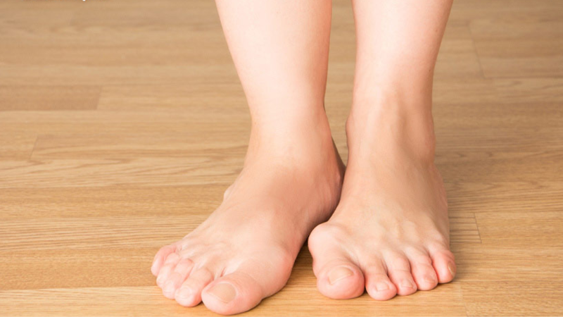 Dị tật bàn chân thường gặp theo nhóm tuổi 1