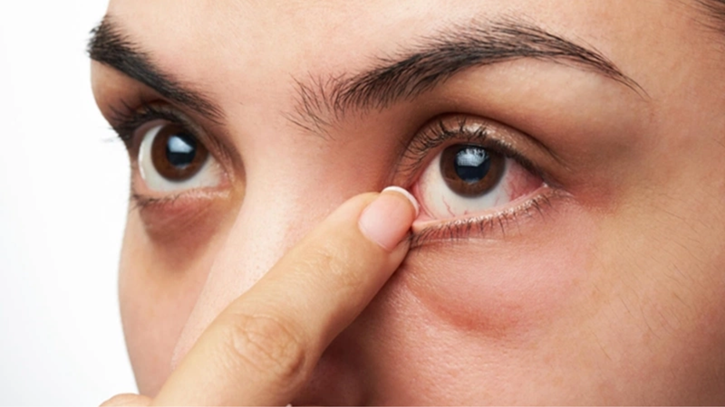 Dị vật trong mắt là gì? Nguyên nhân, dấu hiệu và các biến chứng nguy hiểm 1