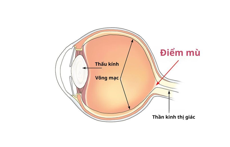 Tìm hiểu chi tiết về điểm mù võng mạc: Tác hại và cách khắc phục 1