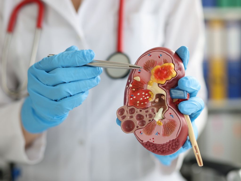 Điều chỉnh liều kháng sinh cho bệnh nhân suy thận và những điều cần biết 2