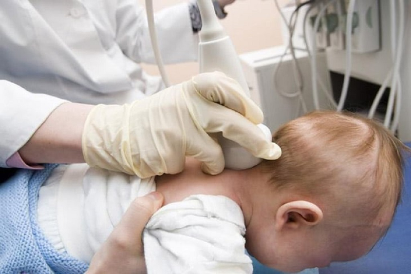 Dính khớp sọ sơ sinh ở trẻ em: Nguyên nhân, triệu chứng nhận biết và cách điều trị bệnh 4