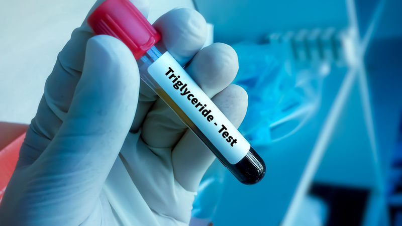 Định lượng triglycerid là gì? Biện pháp kiểm soát nồng độ triglycerid bạn nên biết 1