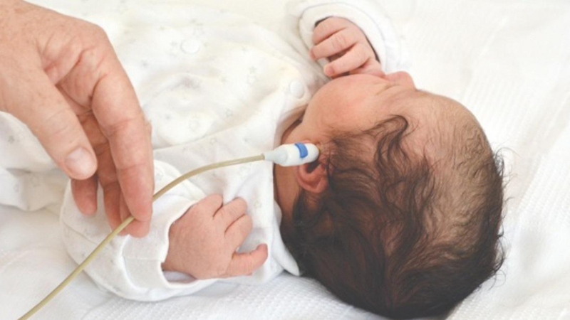 Đo thính lực trẻ sơ sinh là gì? Những thông tin cần biết 1