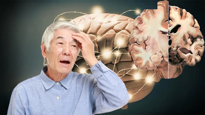 Đường làm trầm trọng thêm bệnh Alzheimer: Bạn có biết? 1