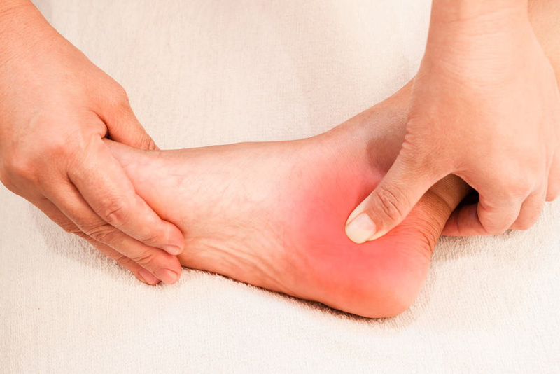 Đứt gân gót chân: Nguyên nhân, dấu hiệu và cách điều trị 2
