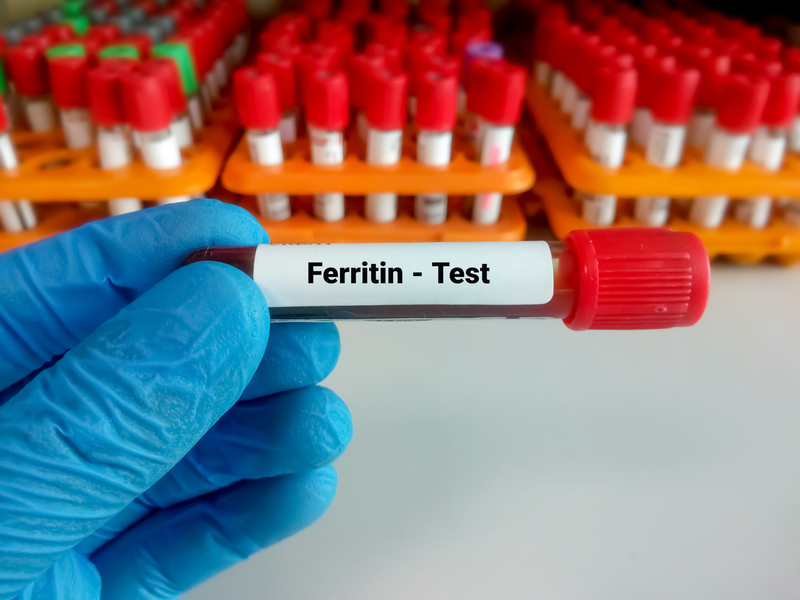 Ferritin tăng là tình trạng gì? Cần làm gì khi Ferritin tăng 3