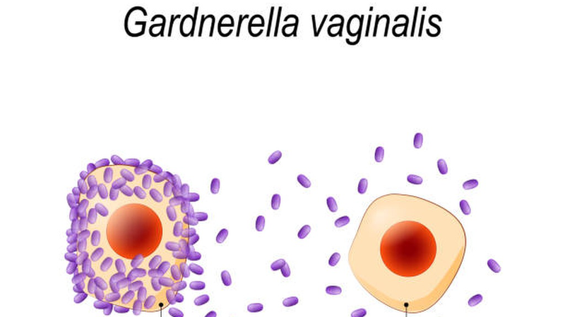 Gardnerella Vaginalis là gì? Ảnh hưởng của nó đến sức khỏe âm đạo 1