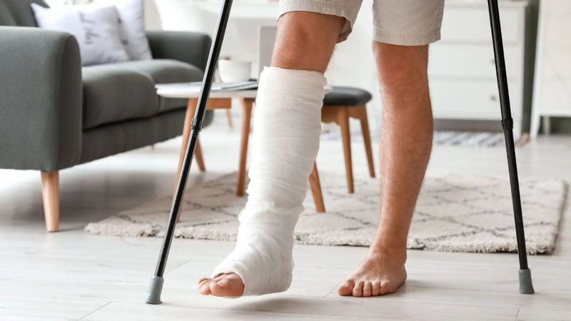 Gãy xương mác có đá bóng được không? Lời khuyên từ chuyên gia 3