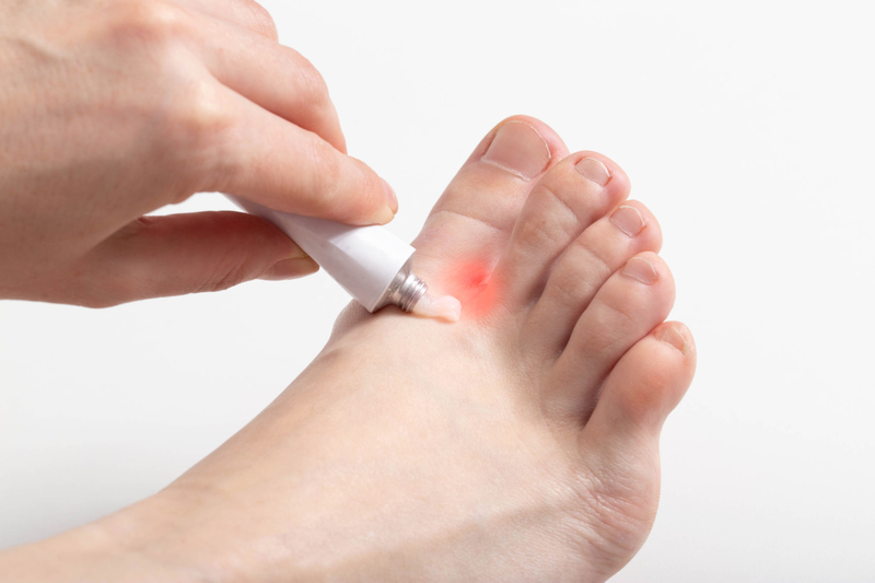 Ghẻ nước ở chân là gì? Chữa trị như thế nào? 4
