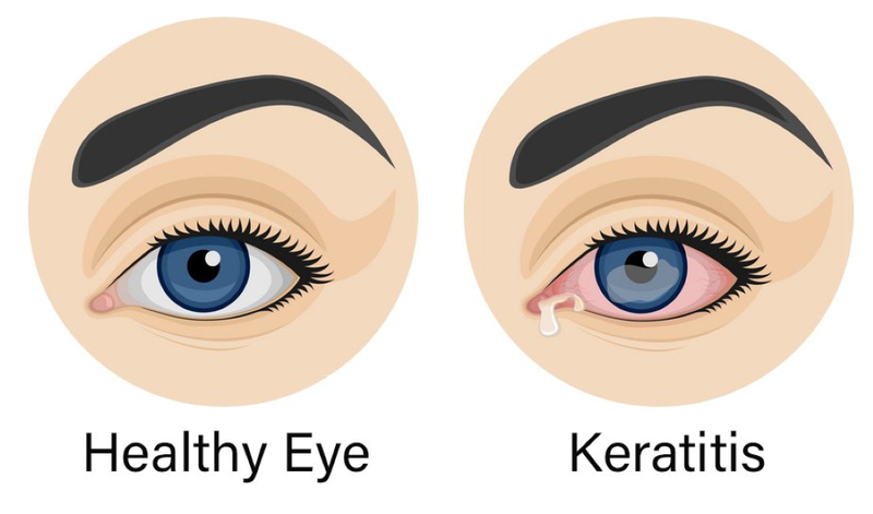 Giải phẫu mắt và các bệnh lý về mắt 5