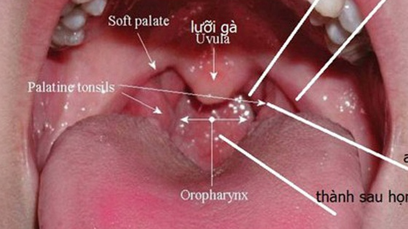Giải phẫu mũi họng: Cấu trúc và chức năng quan trọng của cơ thể 3