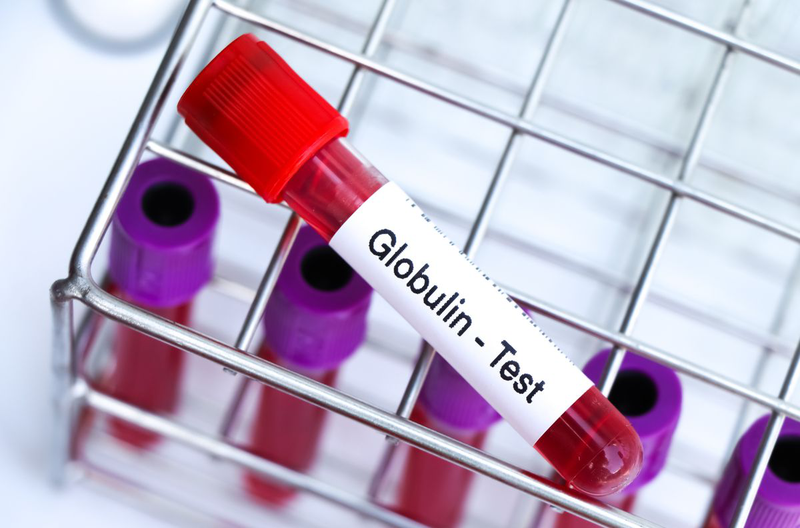 globulin-mien-dich-4.jpg