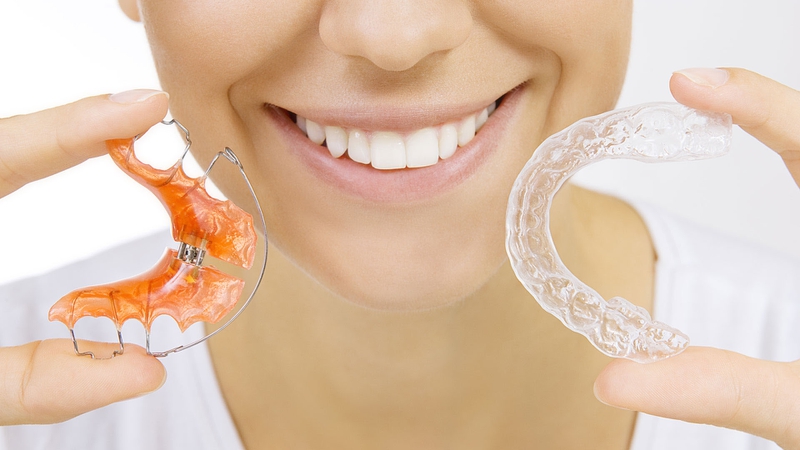 Vệ Sinh Hàm Duy Trì Vivera Khá Đơn Giản